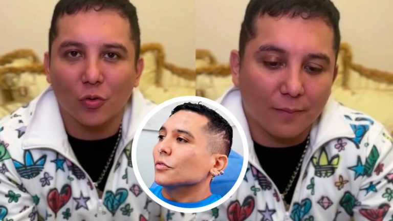 A Edwin Luna le llueven las críticas por tunerse: “Ni volviendo a nacer será guapo”