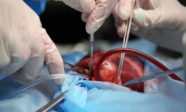 Madre rarámuri dona riñón y da nueva vida a su hija en el Hospital Central