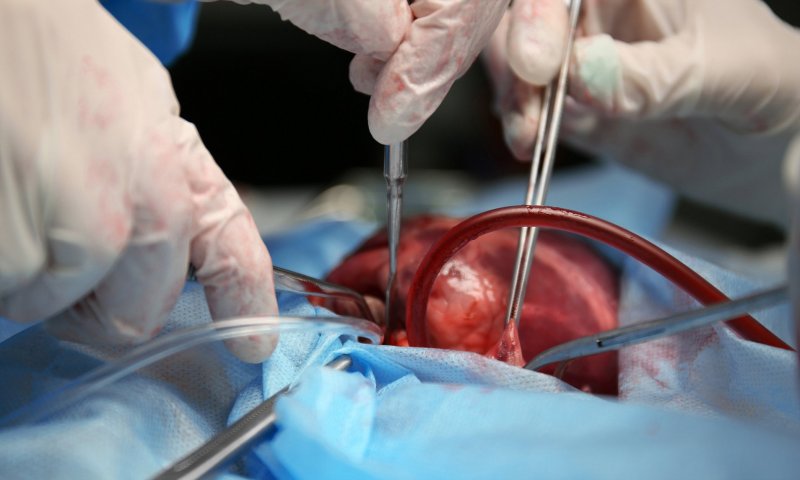 Madre rarámuri dona riñón y da nueva vida a su hija en el Hospital Central